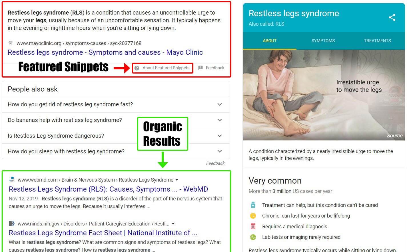 Featured snippets vs organic results